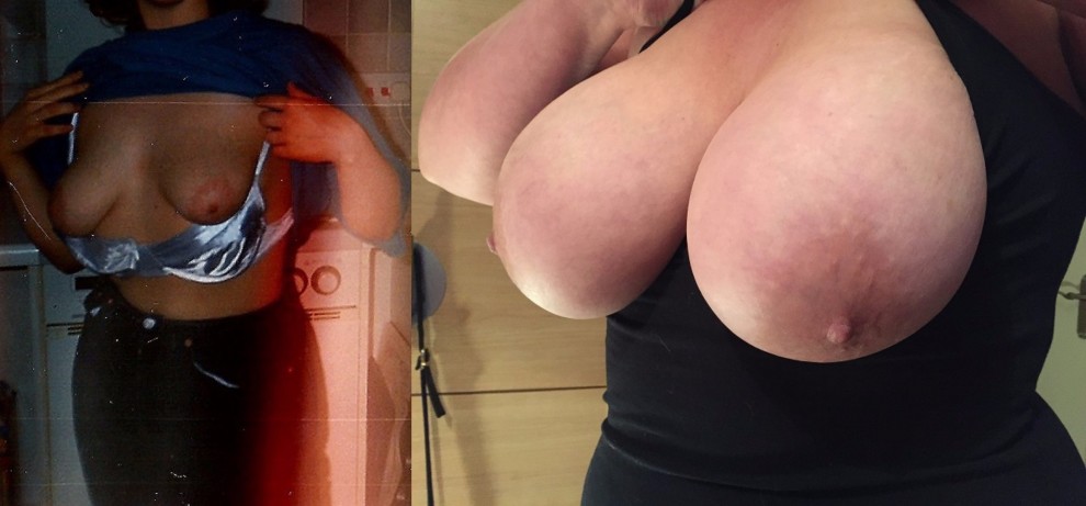 My wife's boobs when she was 21 then a 34B and now 40F