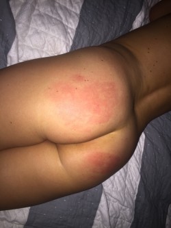 Ouch. In a good way. (F)