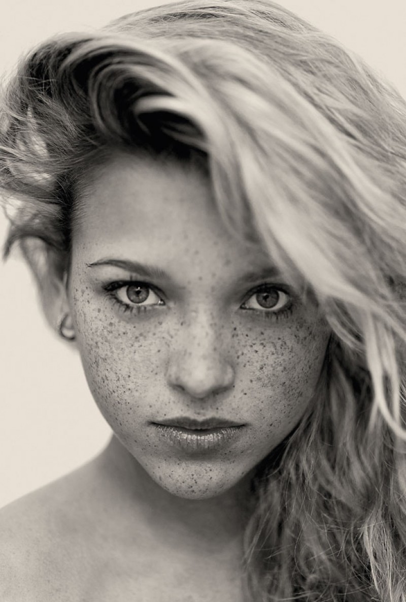 Gorgeous Freckles